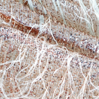 Fringe